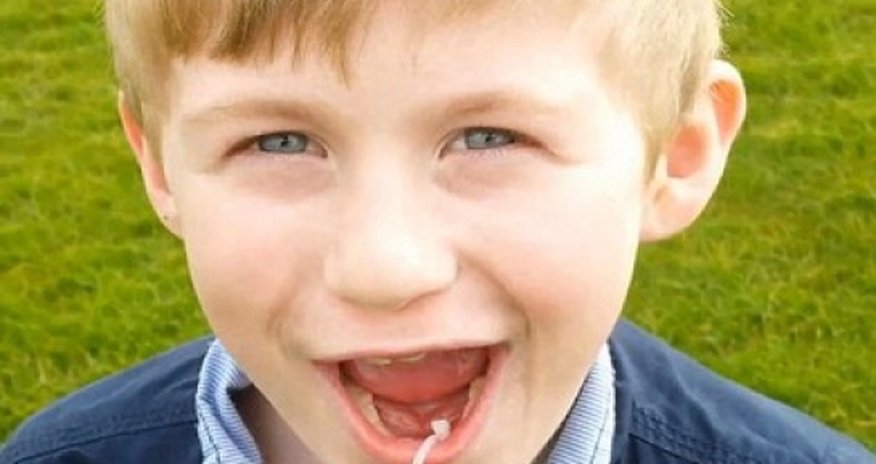 8-летнему мальчику выдернули зуб при помощи вертолета -ВИДЕО 8-летнему мальчику выдернули зуб при помощи вертолета -ВИДЕО