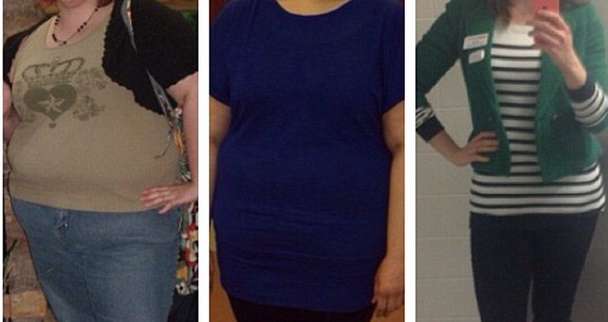 Woman, 28, who lost 172 pounds - PHOTO Woman, 28, who lost 172 pounds - PHOTO