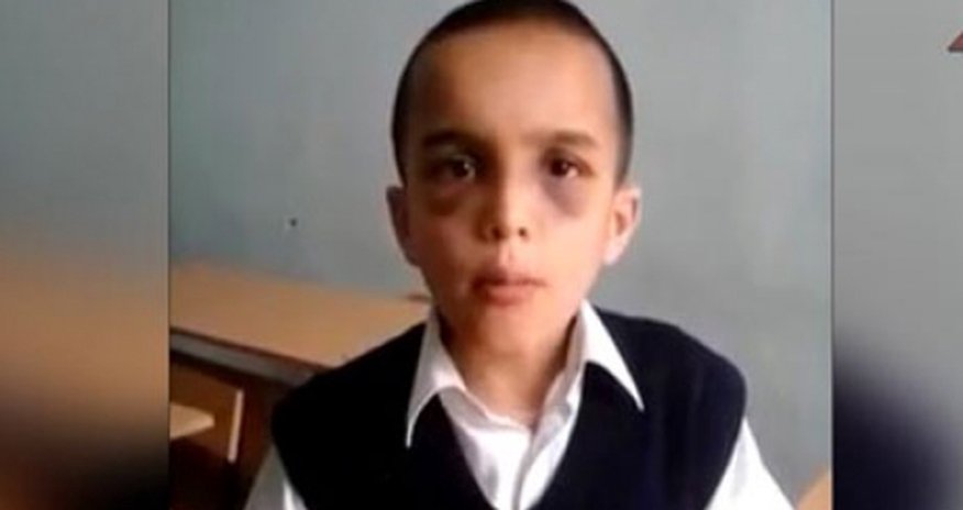 Uşaq döyən müəllimə nazirliyə çağırıldı Uşaq döyən müəllimə nazirliyə çağırıldı