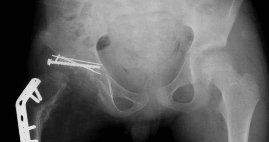 Norwegian artist eats his own hip for exhibition Norwegian artist eats his own hip for exhibition