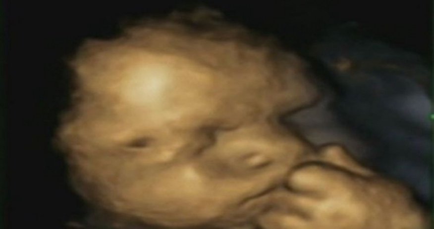 Is this picture proof that unborn babies feel mother's stress? Is this picture proof that unborn babies feel mother's stress?