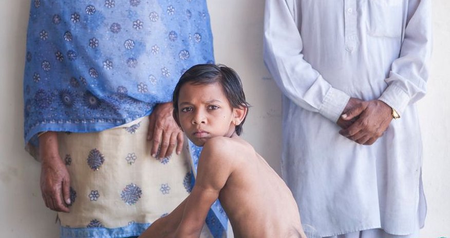 Boy born with with seven-inch TAIL worshipped as a God - PHOTO Boy born with with seven-inch TAIL worshipped as a God - PHOTO