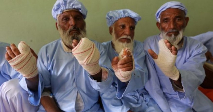 Taliban slice off 11 people's fingers as punishment - VIDEO Taliban slice off 11 people's fingers as punishment - VIDEO