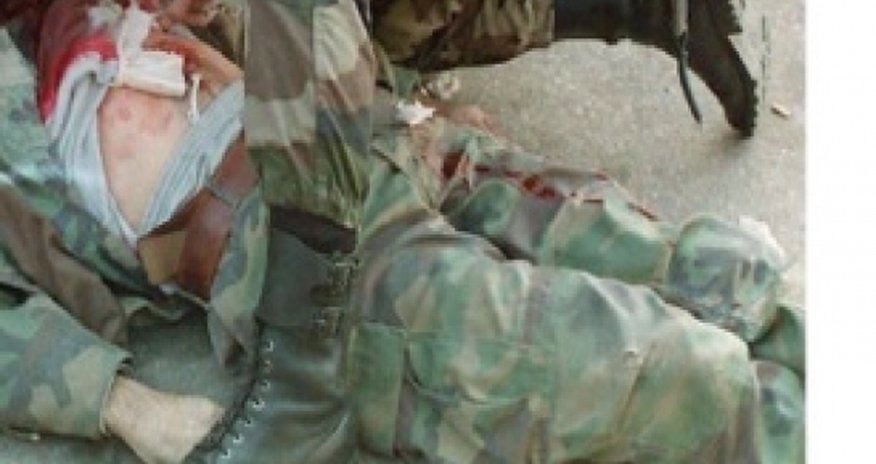 Ранен азербайджанский военнослужащий Ранен азербайджанский военнослужащий