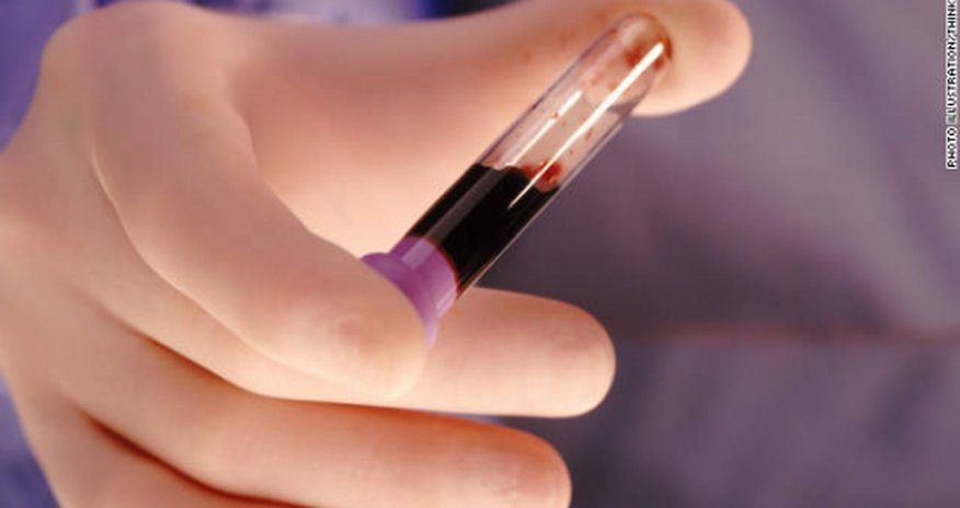 Could a blood test predict suicides? Could a blood test predict suicides?