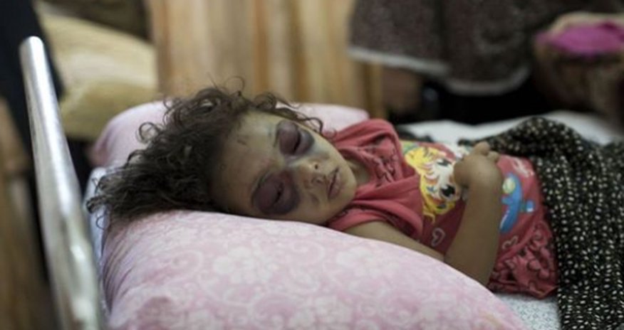 The girl who became a symbol of the plight of children in Gaza The girl who became a symbol of the plight of children in Gaza