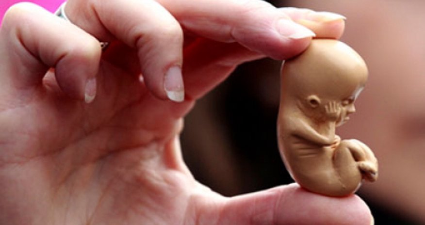 Ölkədə 27 892 qadın abort etdirib - Statistika Ölkədə 27 892 qadın abort etdirib - Statistika