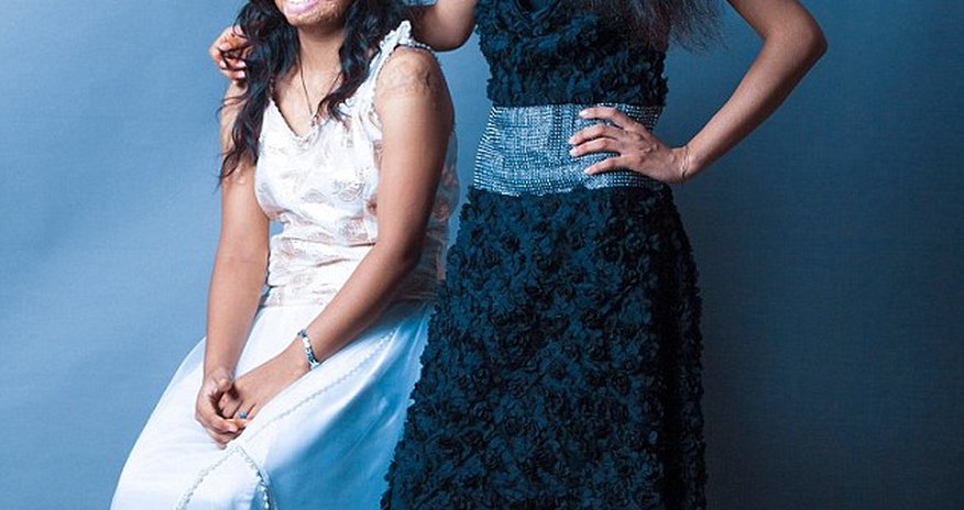 Acid attack survivors unite for inspirational fashion shoot - PHOTO Acid attack survivors unite for inspirational fashion shoot - PHOTO