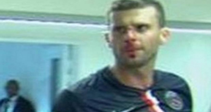 Thiago Motta head-butted Thiago Motta head-butted