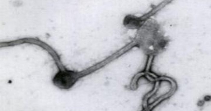 Several persons in Azerbaijan call “hotline” on suspicion of Ebola virus Several persons in Azerbaijan call “hotline” on suspicion of Ebola virus