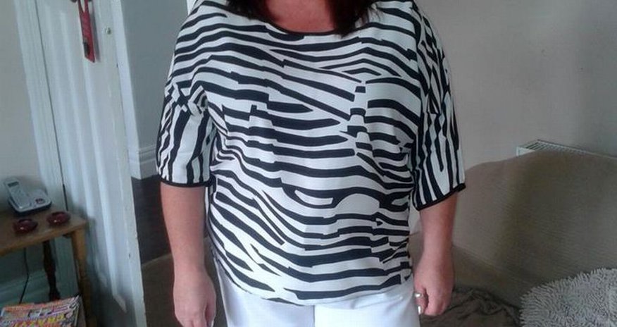 Mum taken to hospital TWICE after spider bite left her unable to walk - PHOTO Mum taken to hospital TWICE after spider bite left her unable to walk - PHOTO