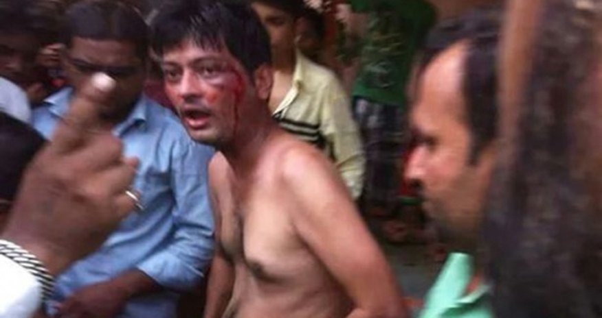 Angry mob hacks off alleged rapist's genitals Angry mob hacks off alleged rapist's genitals