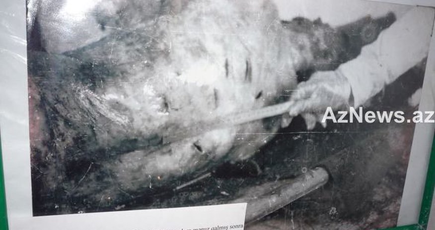 Ужасные фотографии, доказывающее зверство армян - ФОТО Ужасные фотографии, доказывающее зверство армян - ФОТО