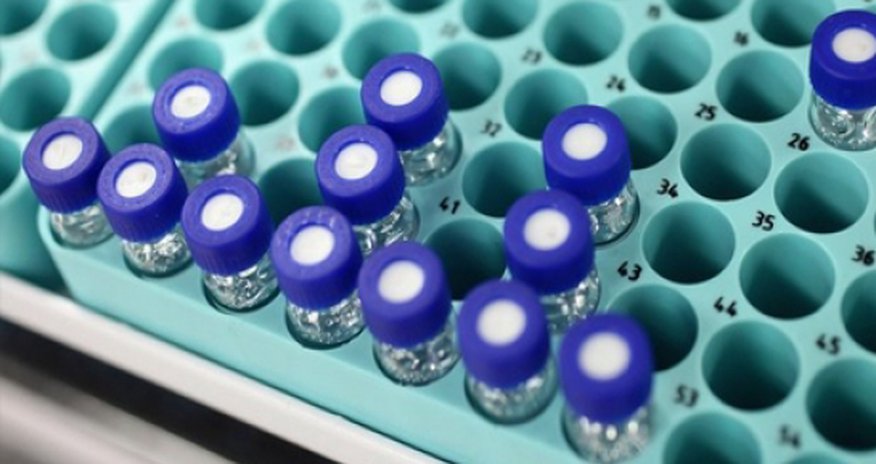 World Cup anti-doping solution found World Cup anti-doping solution found
