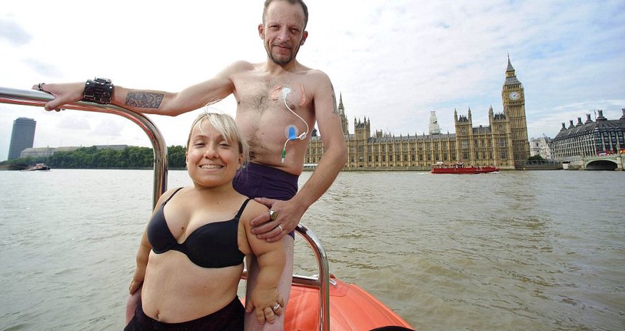 'Undressing Disability 2014' calendar - PHOTO 'Undressing Disability 2014' calendar - PHOTO