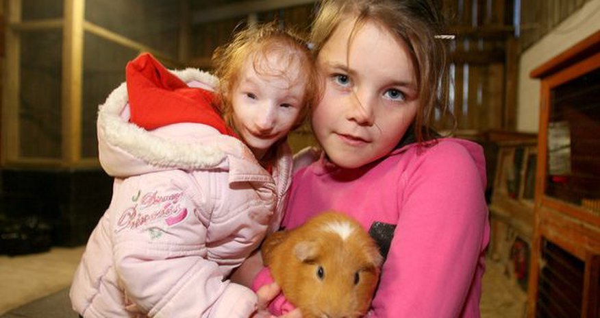 Smallest six-year-old in world meets GIANT RABBIT - PHOTO Smallest six-year-old in world meets GIANT RABBIT - PHOTO