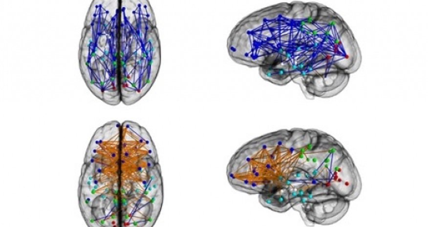 Men and women's brains are 'wired differently' Men and women's brains are 'wired differently'