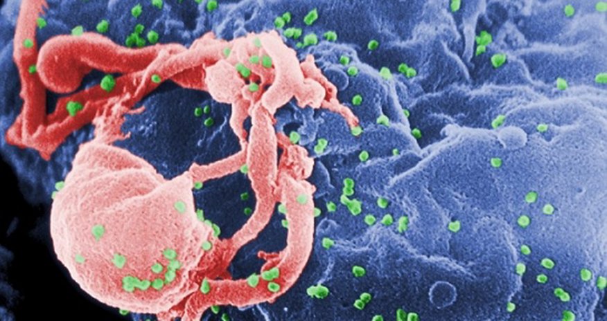 Scientists discover radiation 'bomb' that could wipe out HIV Scientists discover radiation 'bomb' that could wipe out HIV