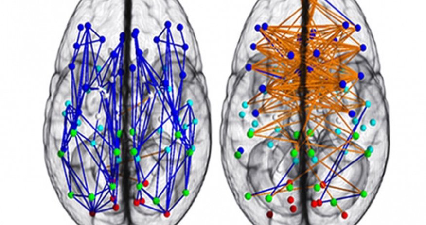 Sex and brains: Men and women are different Sex and brains: Men and women are different