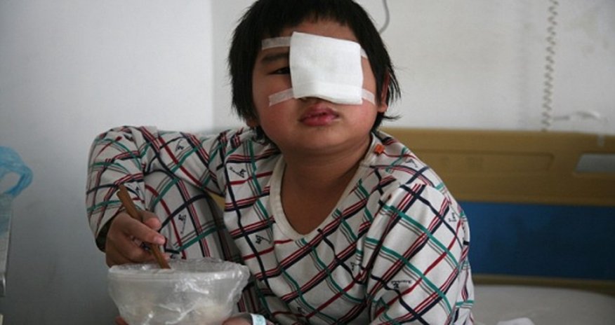 Teacher orders classmates to slap boy in the eye 40 times Teacher orders classmates to slap boy in the eye 40 times