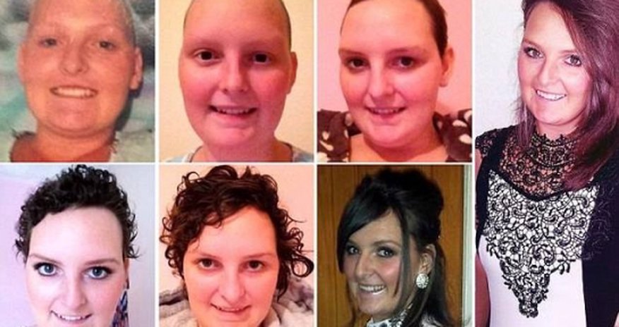 Cancer survivor left bald after treatment charts recovery Cancer survivor left bald after treatment charts recovery