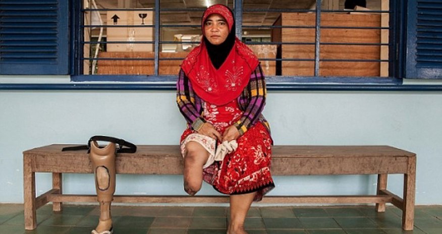 Pictured: Cambodian land mine victims - PHOTO Pictured: Cambodian land mine victims - PHOTO