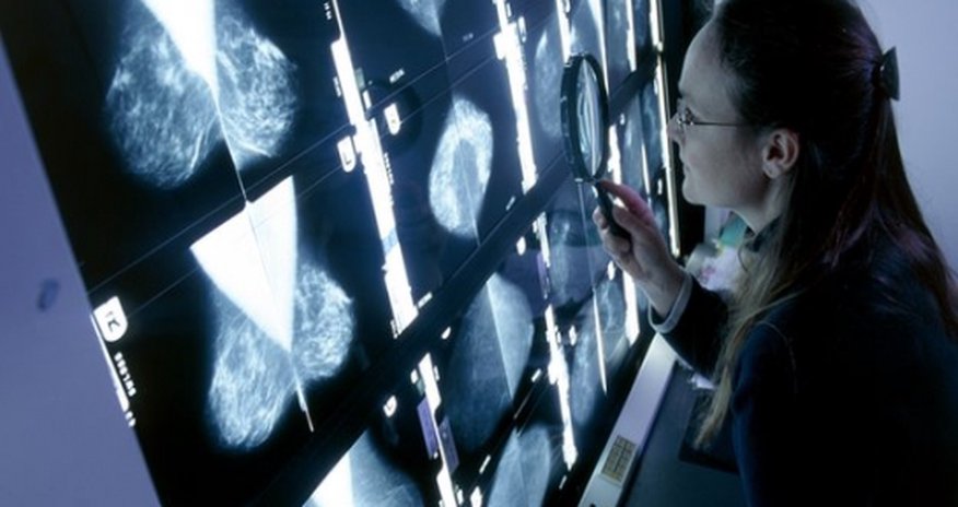 Cancer 'tidal wave' on horizon, warns WHO Cancer 'tidal wave' on horizon, warns WHO