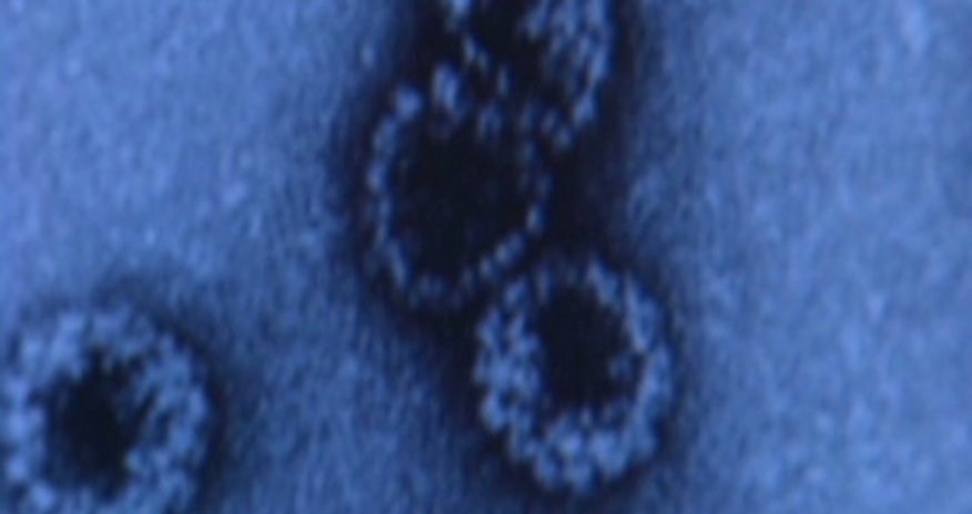 Imminent global cancer 'disaster' reflects aging Imminent global cancer 'disaster' reflects aging