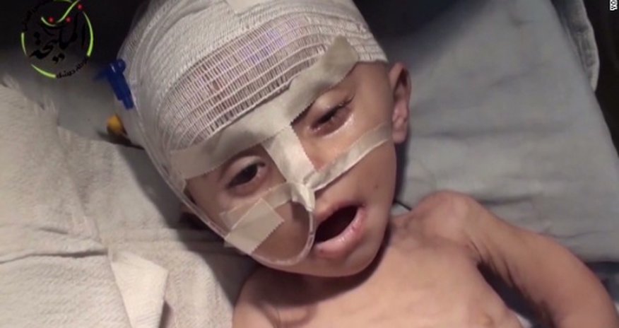 Syrian children dying of hunger Syrian children dying of hunger