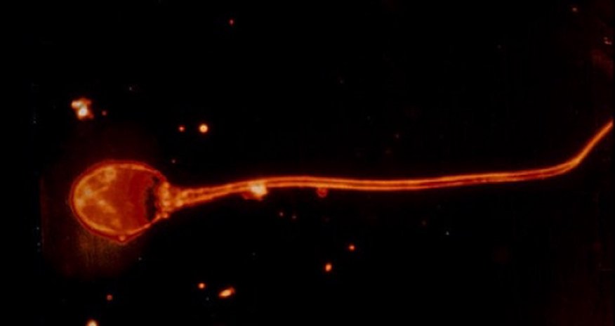 Gentlemen, your sperm is under attack – but don't panic Gentlemen, your sperm is under attack – but don't panic