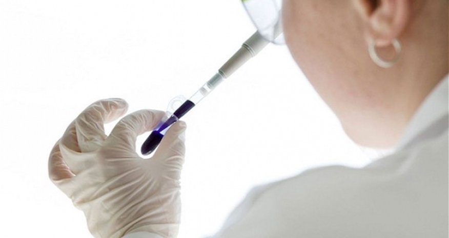 'Death test' predicts chance of healthy person dying within five years 'Death test' predicts chance of healthy person dying within five years