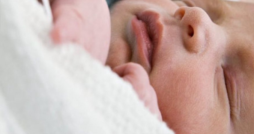 C-section birth "link to later obesity" C-section birth "link to later obesity"