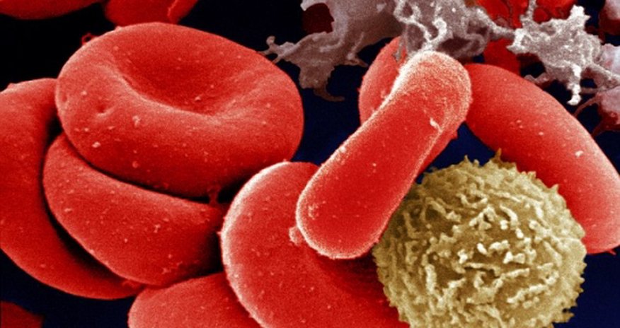 Thousands of healthy people wrongly told they have cancer Thousands of healthy people wrongly told they have cancer
