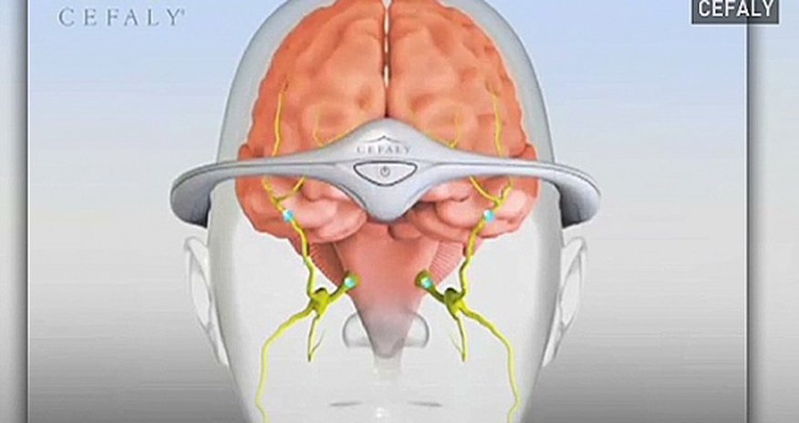 Device worn on the head may prevent them Device worn on the head may prevent them