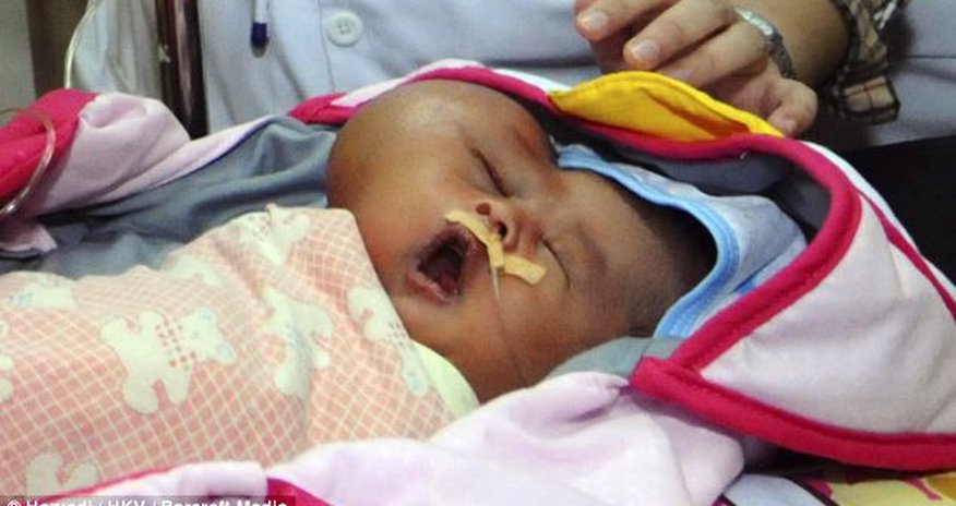 Baby with a heart-shaped head - PHOTO Baby with a heart-shaped head - PHOTO