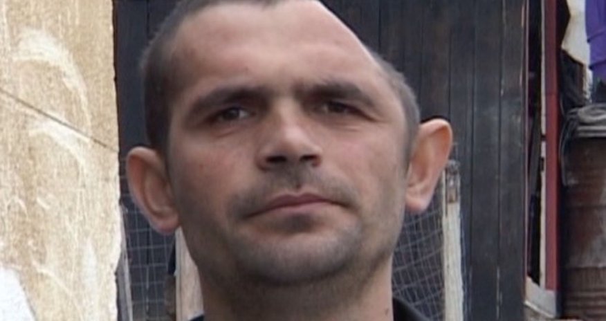 Shocking images of man who lost half of his HEAD - PHOTO+VIDEO Shocking images of man who lost half of his HEAD - PHOTO+VIDEO