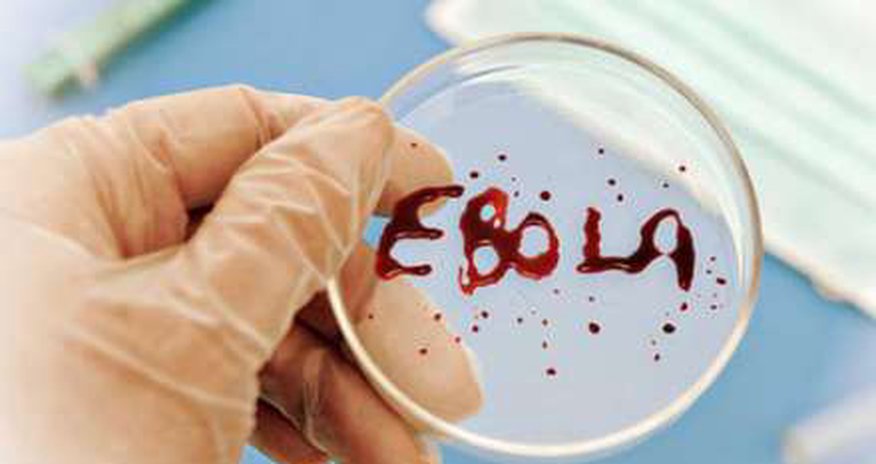 “Ebola” virusunu ABŞ icad edib - İDDİA “Ebola” virusunu ABŞ icad edib - İDDİA