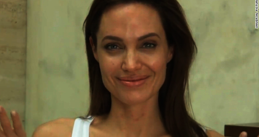 Angelina Jolie's chickenpox explained Angelina Jolie's chickenpox explained