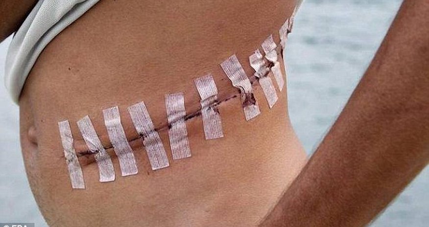 How ISIS is selling human organs How ISIS is selling human organs