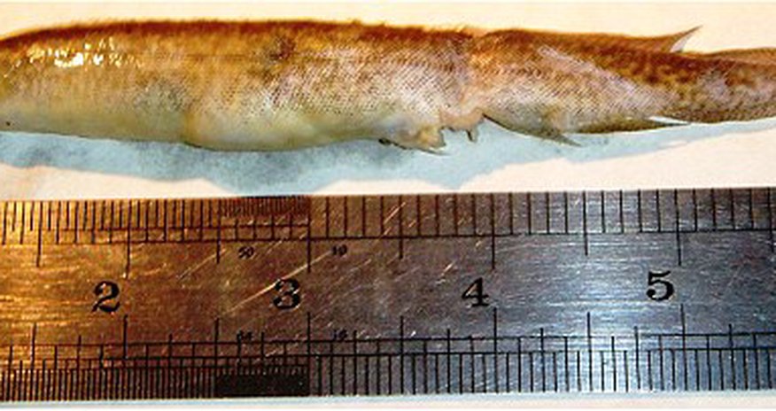 Teenager has 6-inch live EEL gets stuck in his throat for five hours Teenager has 6-inch live EEL gets stuck in his throat for five hours