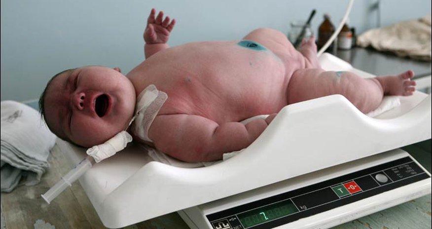 Russian mother has 'giant' baby Russian mother has 'giant' baby