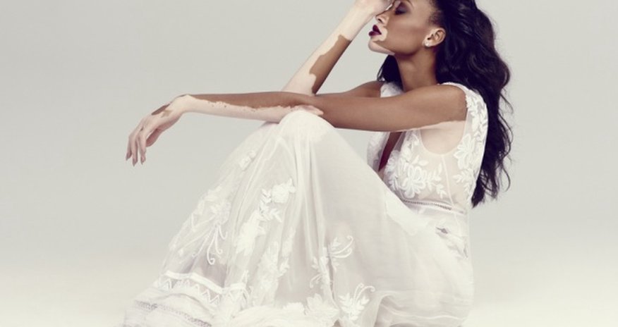 Chantelle Winnie: ‘I’m proud of my skin’ Chantelle Winnie: ‘I’m proud of my skin’