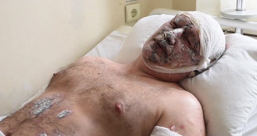 Ukraine coal mine: Dozens feared dead in Zasyadko gas blast Ukraine coal mine: Dozens feared dead in Zasyadko gas blast