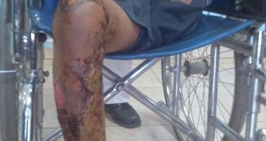 Yemeni boy, 10, locked in a cage and set alight by his friends Yemeni boy, 10, locked in a cage and set alight by his friends