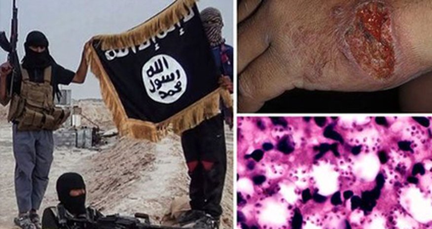 İŞİD ölümcül xəstəliyin ağuşunda İŞİD ölümcül xəstəliyin ağuşunda