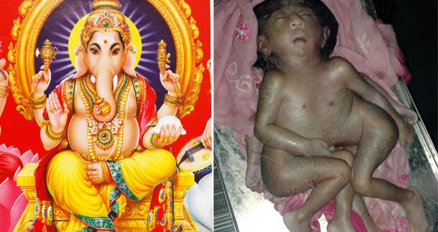Baby born with EIGHT limbs worshipped as 'Hindu God' Baby born with EIGHT limbs worshipped as 'Hindu God'