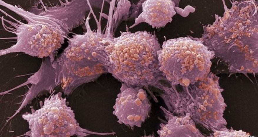 Prostate cancer drug 'extends lives' Prostate cancer drug 'extends lives'
