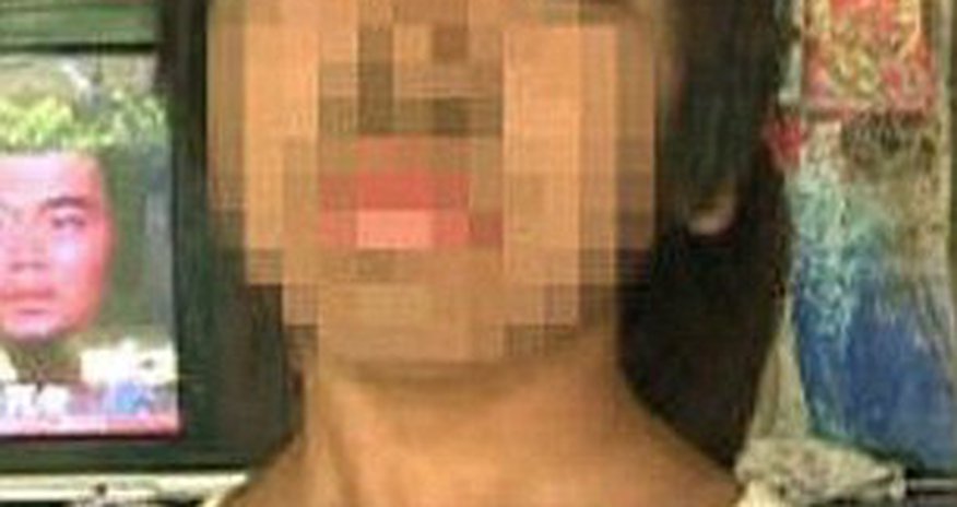 The girl covered from head to toe in coarse dark hair The girl covered from head to toe in coarse dark hair
