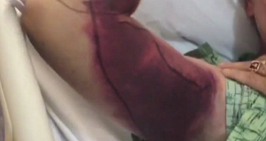 Man almost dies after trying to take selfie with a snake Man almost dies after trying to take selfie with a snake