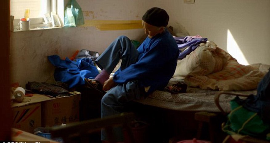 The agony of living with bound feet The agony of living with bound feet